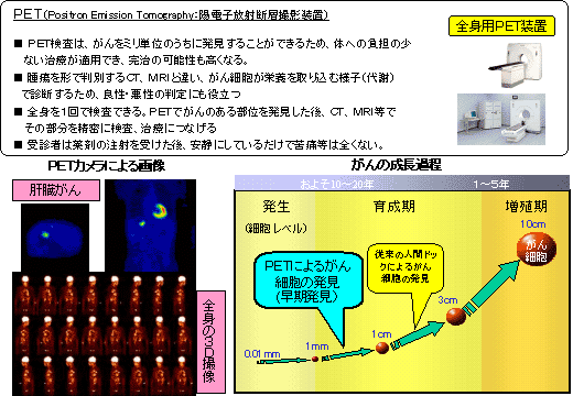 ＰＥＴを中核とした高度健診